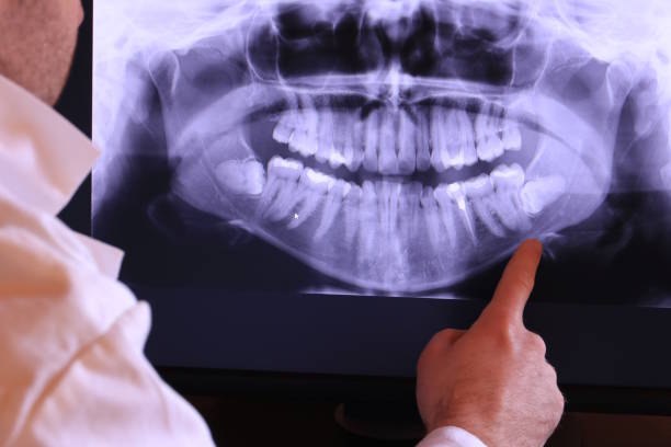 Best Emergency Root Canal Treatment in Lenox, IA